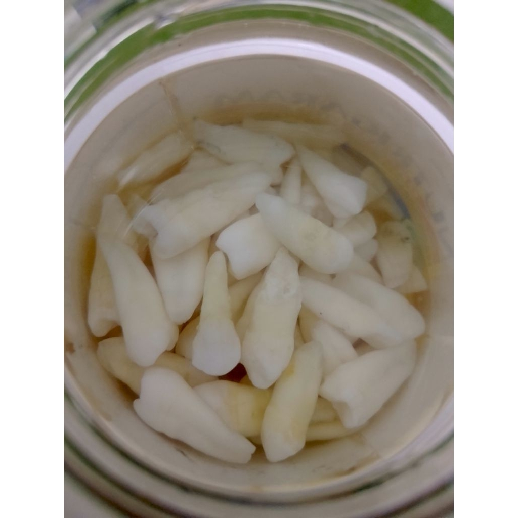 Gigi Premolar dewasa asli