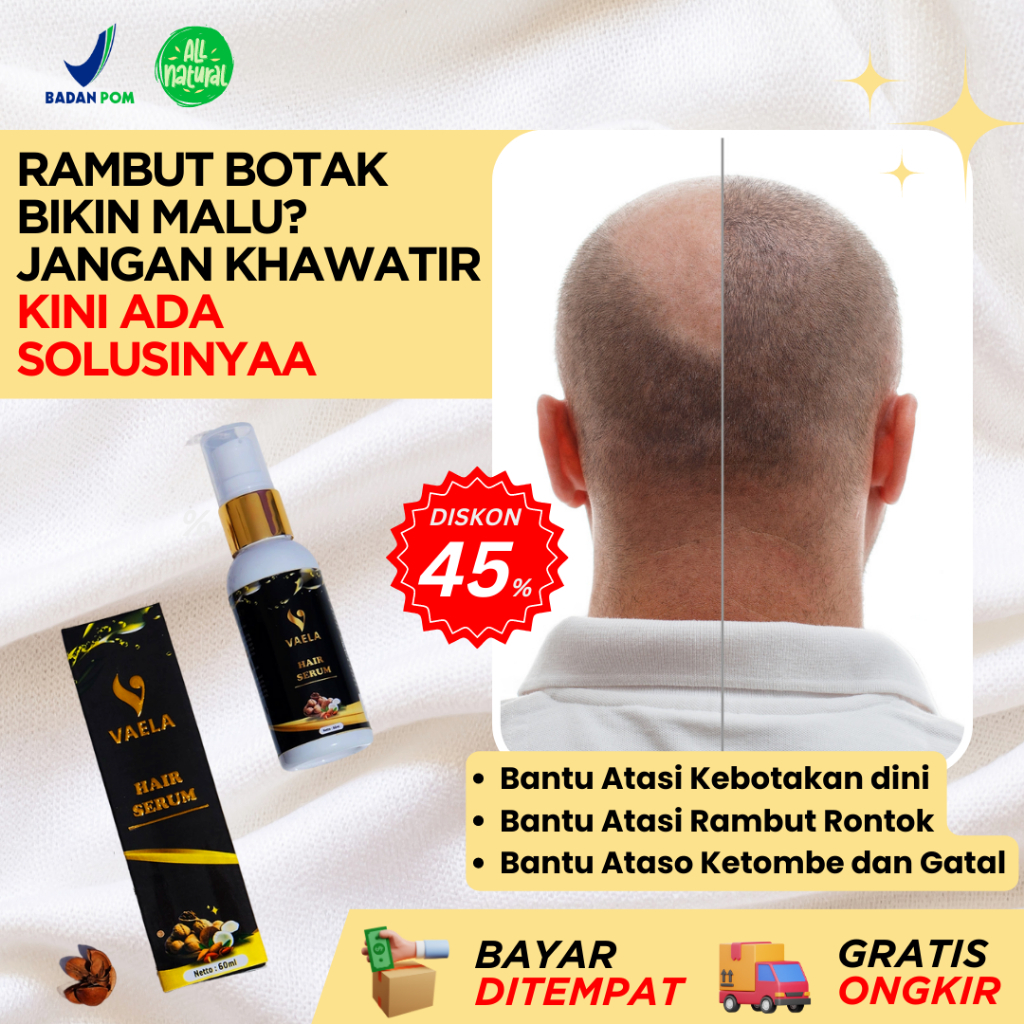 Vaela Hair Serum – Untuk Rambut Lebat, Anti Rontok & Sehat