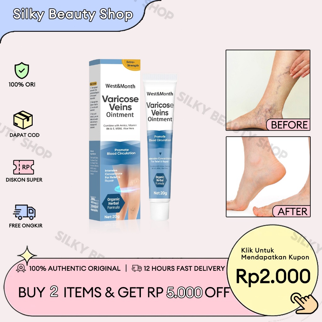 West&Month [ORI] Krim Varises 20g Varicose Veins Cream Obat Varises Salep Krim Efektif Penghilang Va