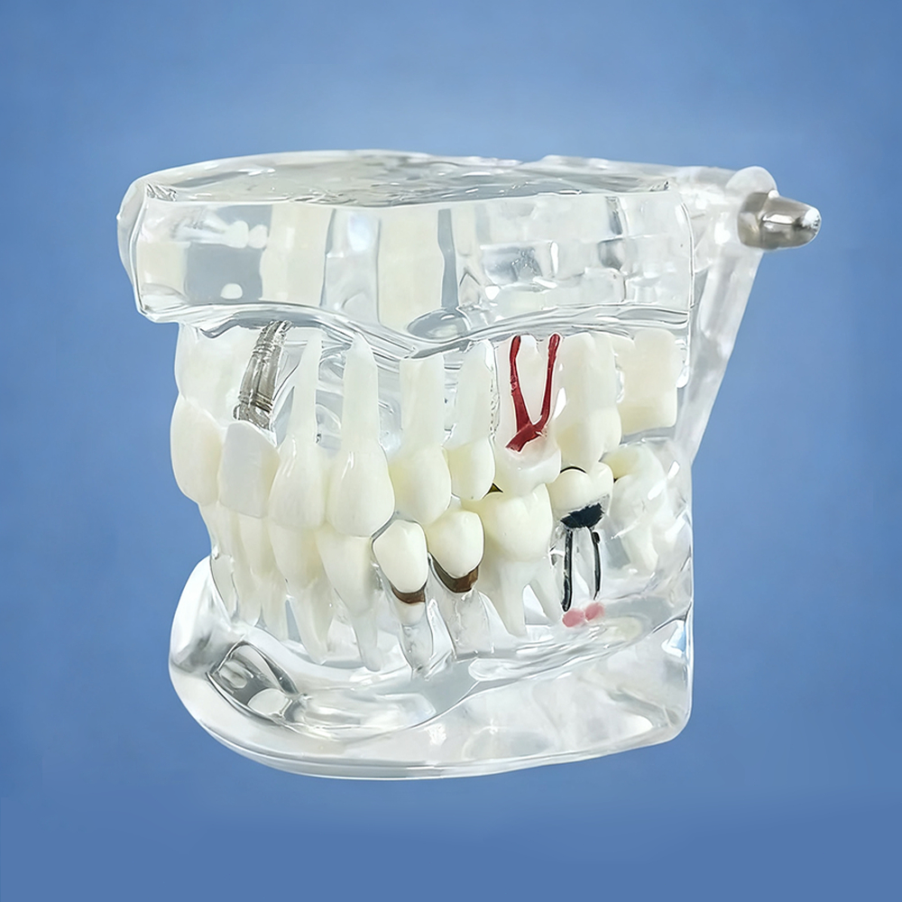 RS-DENTAL model gigi Dental Study Model Phantom Gigi bisa di lepas transparan