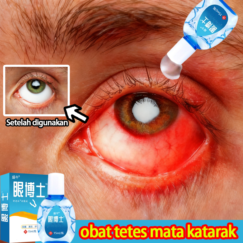 Obat Tetes Mata Katarak Tetes Mata No 1 Di Jepang Tetes Mata Katarak Tanpa Mata kering mata perih ma