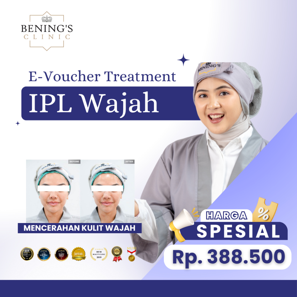 Bening's Clinic IPL Wajah Treatment