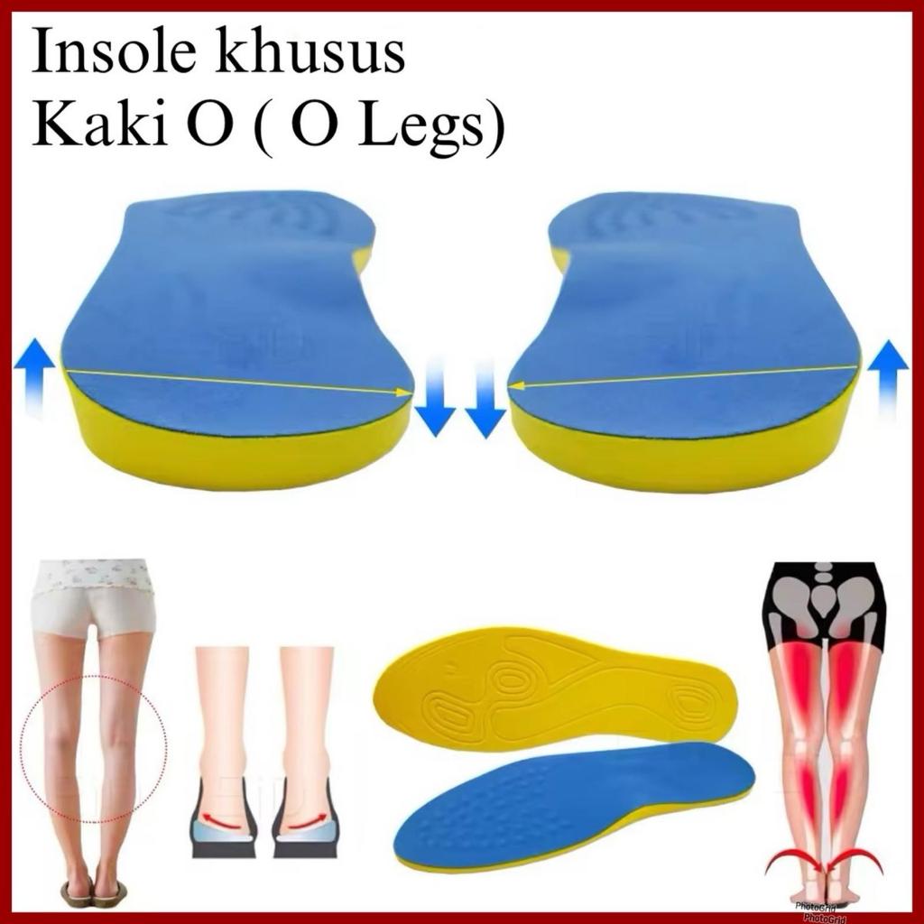 INSOLE SEPATU SUPPORT KAKI O / O LEGS INSOLE ARCH SUPPORT INSOLE