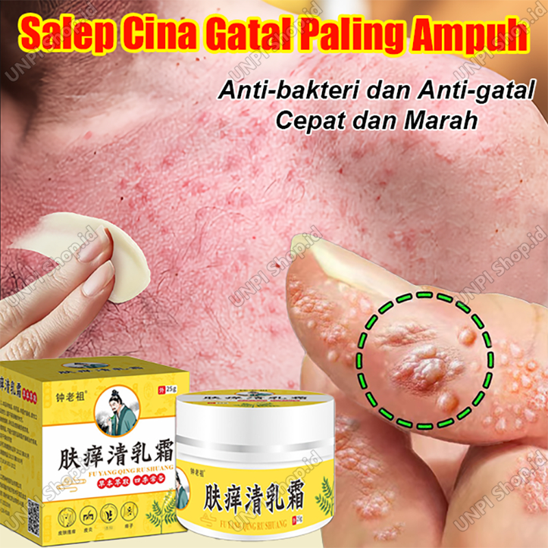 Salep Cina Gatal Paling Ampuh Original Salep Eksim Kering Dan Gatal Obt Gatal Seluruh Badan Obat Gat