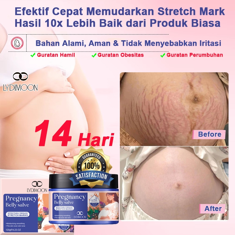Krim Stretch Mark Herbal, efektif menghilang stretch mark cream penghilang 120g Hilangkan Cepat Stre