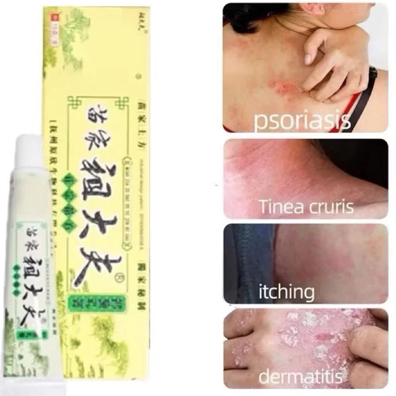 salep gatal dewasa original // salep gatal kurap // salep gatal untuk kulit // salep gatal bpom