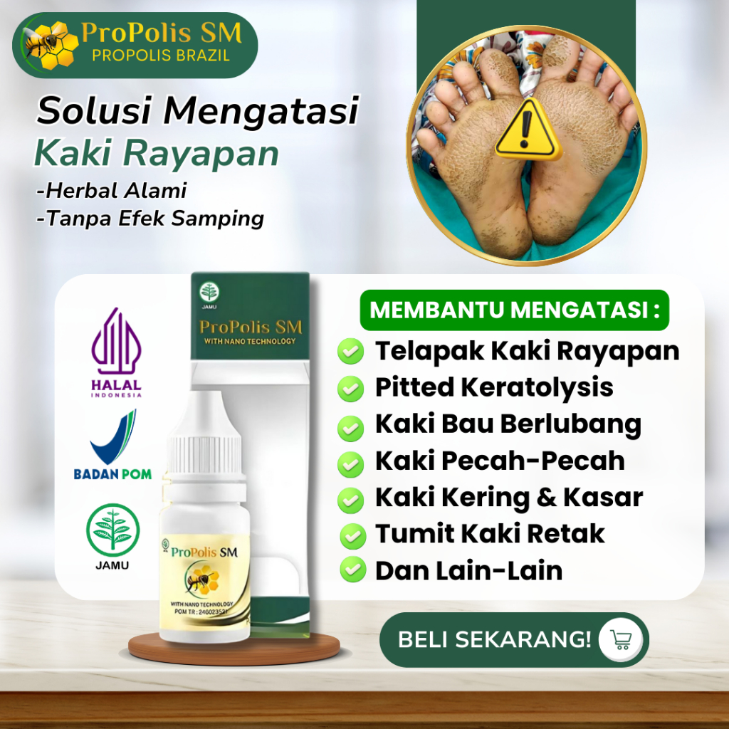 Obat Tetes Telapak Kaki Berlubang Kecil Kecil - Obat Kaki Rayapan - Obat Telapak Kaki Bolong Bolong 