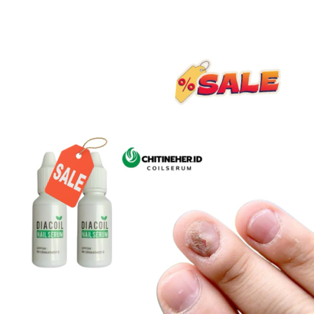 DIACOIL NAIL SERUM 2 PAKET KUKU CENTENGAN & BERNANAH