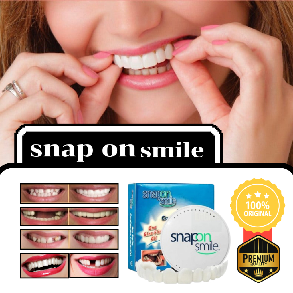 Snap on Smile 1 Set Atas Bawah - Gigi Palsu Snapon Smile - Gigi Palsu Lepas Pasang Veneer Penutup Gi