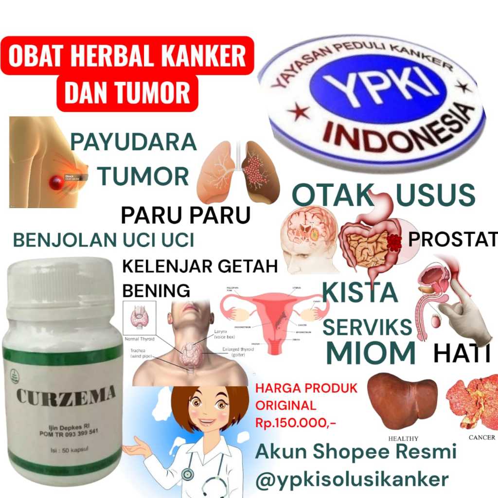OBAT DARI YAYASAN PEDULI KANKER INDONESIA ll OBAT BUAT KANKER PAYUDARA ll OBAT BENJOLAN KANKER PAYUD