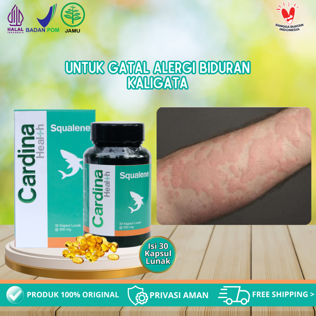 Cardina Health Squalane Obat Herbal Gatal Alergi Biduran Kaligata, Obat Alergi Makanan, Alergi Cuaca