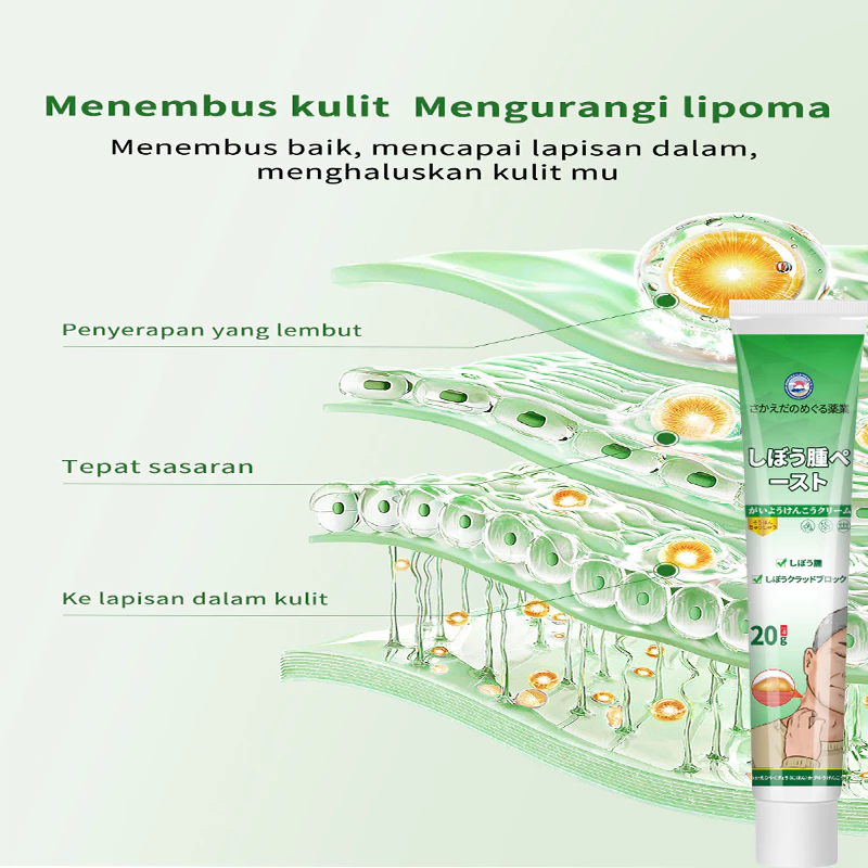 Lipoma Removal Cream Original Obat Benjolan 20g Obat
