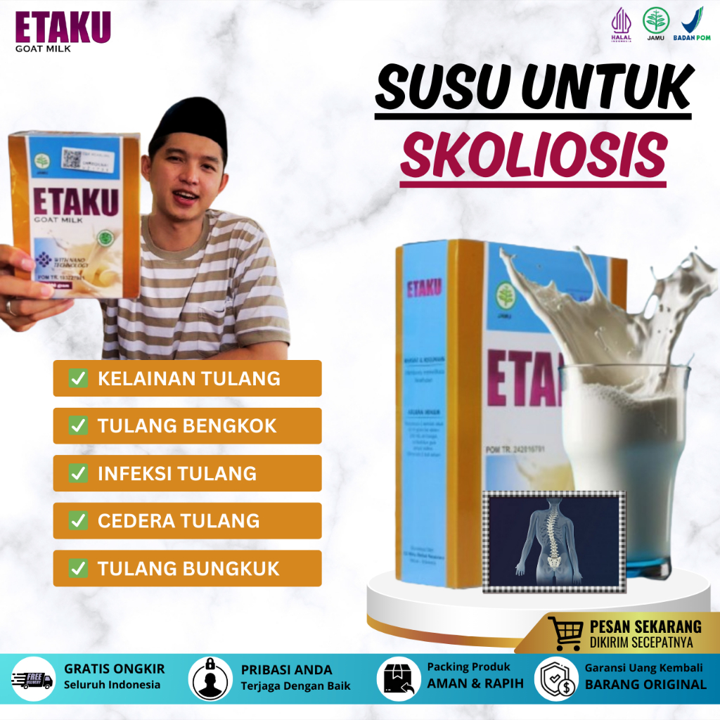 Obat Skoliosis, Obat Tulang Melengkung, Obat Tulang Bengkok, Obat Cedera Tulang, Obat Infeksi Tulang