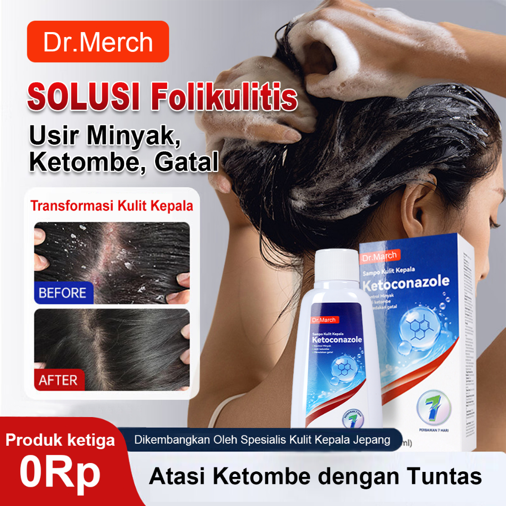 Sampo ketokonazol | Non SLS/SLES | Natural | Perawatan Kulit Kepala Gatal Ketombe Berkerak Sensitif 