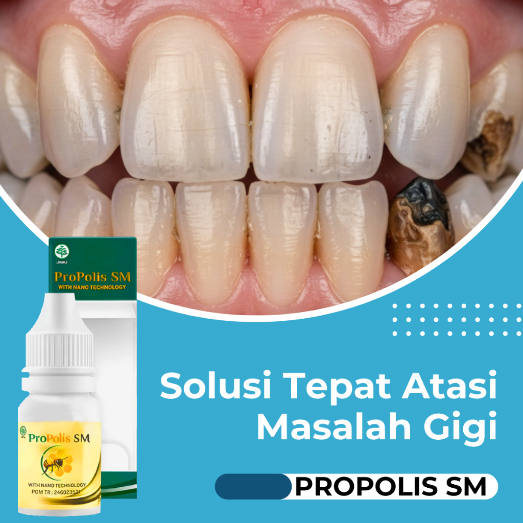 Obat Sakit Gigi Gusi Berlubang - Radang Gusi - Gigi Hitam - Gigi Keropos - Perontok Gigi Bolong - De