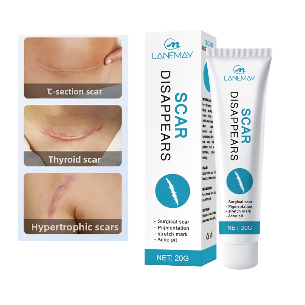 Penghilang bekas luka Scar Remover Cream 20g Scar Removal Cream