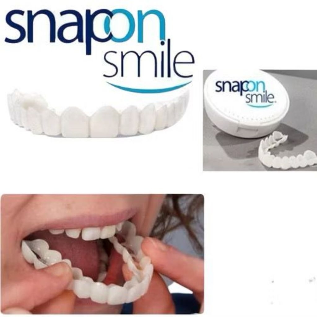 SNAP ON SMILE GIGI PALSU INSTAN ATAS BAWAH