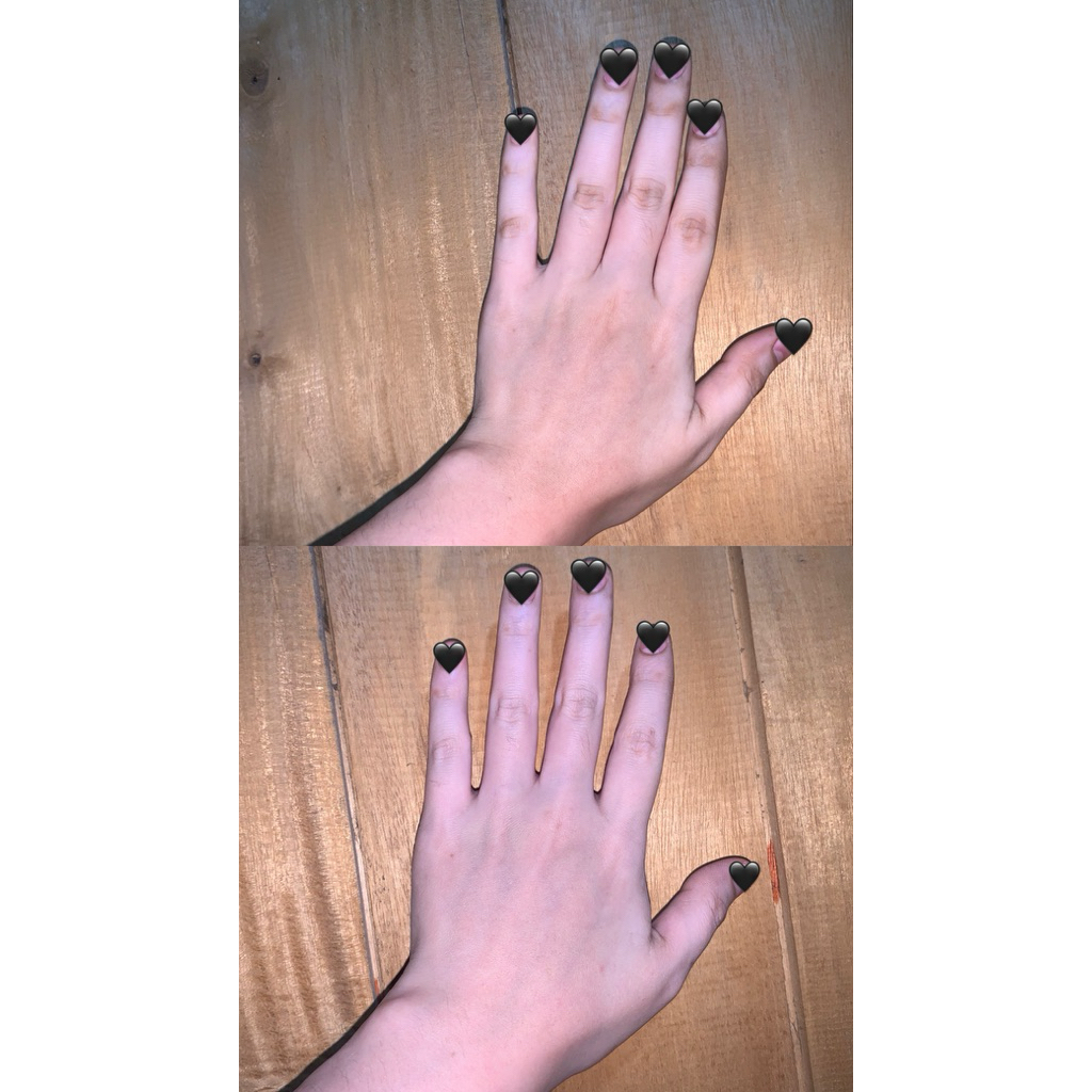 HB DOSTING KULIT BADAK/SUSAH PUTIH