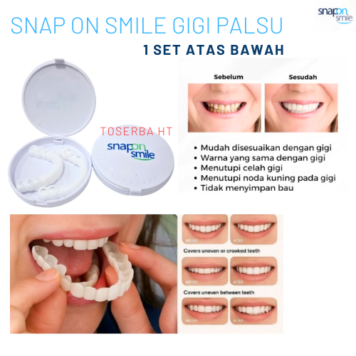 MURAH GIGI PALSU SET Atas bawah fleksibel dan bisa lepas pasang -  putih gigi silikon