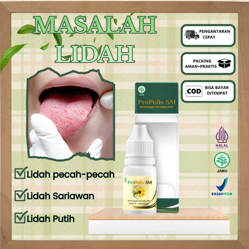 Obat Untuk Masalah Lidah, Lidah Sariawan, Benjolan Di Lidah & Luka Di Lidah, Lidah Terasa Perih-Prop