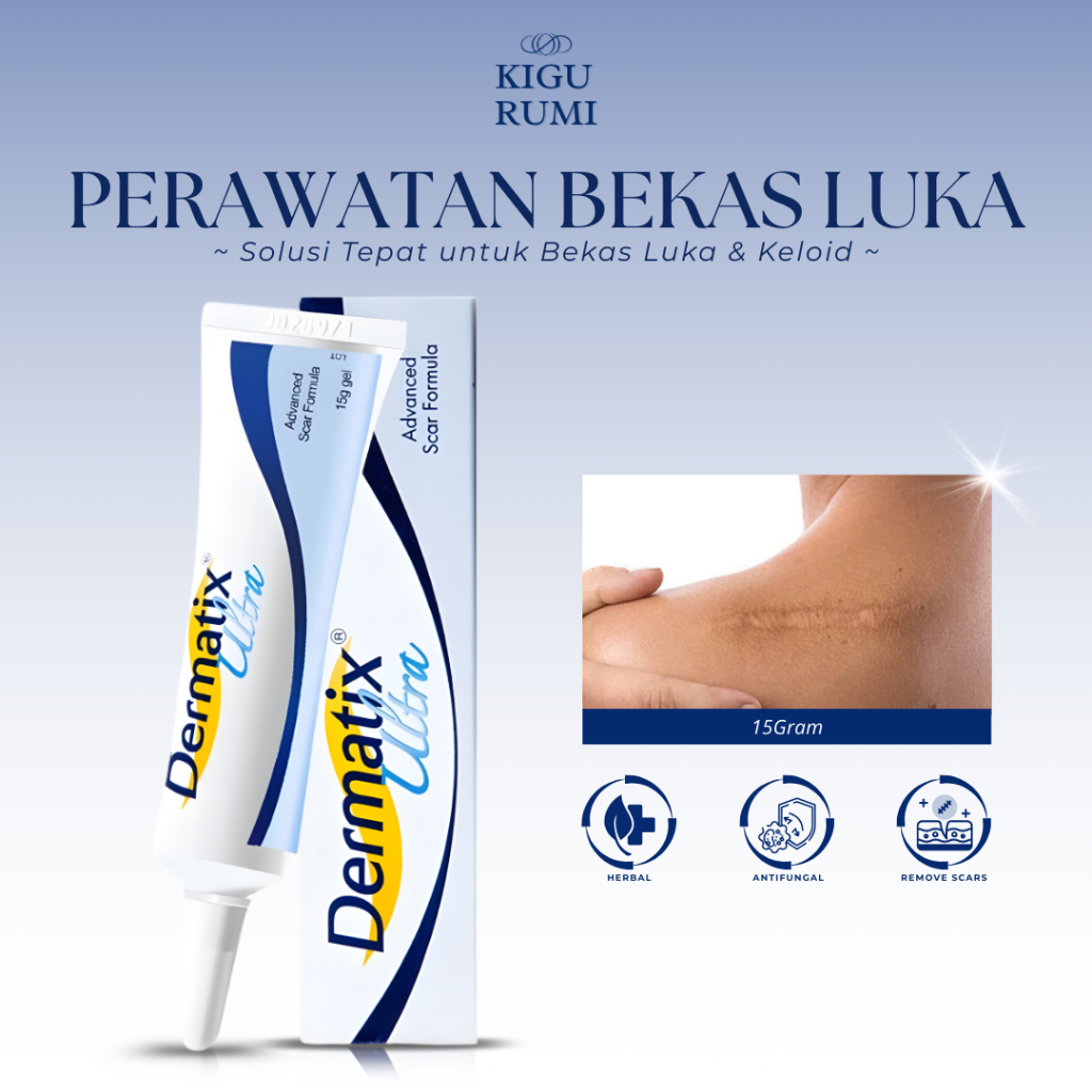 Dermatix Ultra Cream 15gr – Gel Penghilang Bekas Luka & Keloid Ampuh, Cepat Memudar XX156