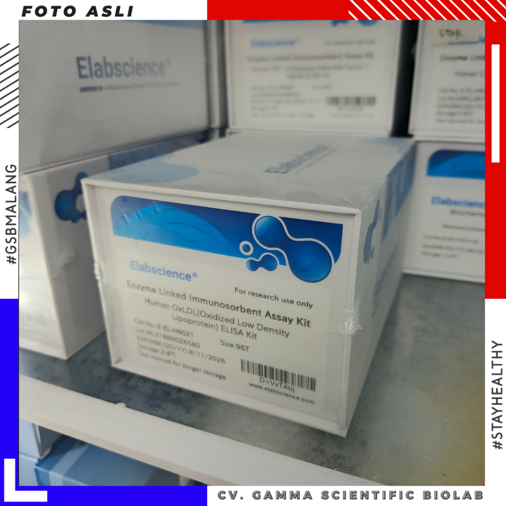 Human OxLDL(Oxidized Low Density Lipoprotein) ELISA Kit 96T (E-EL-H6021) - Elabscience