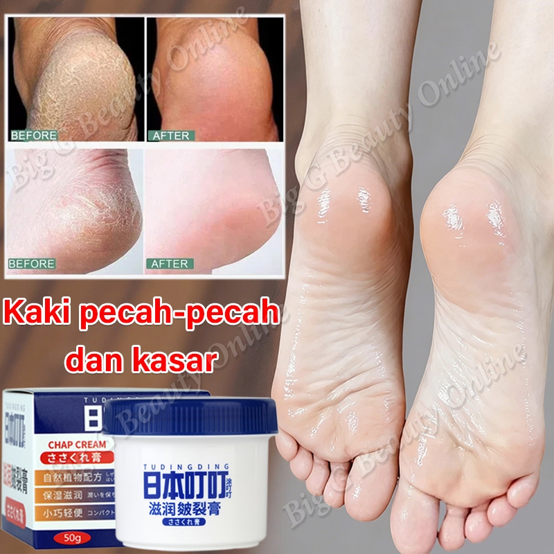 Cream Kaki Pecah Dan Kering Obat Kaki Pecah Pecah Pelembab Kaki Foot Cream Penghalus Kaki Kasar Dan 