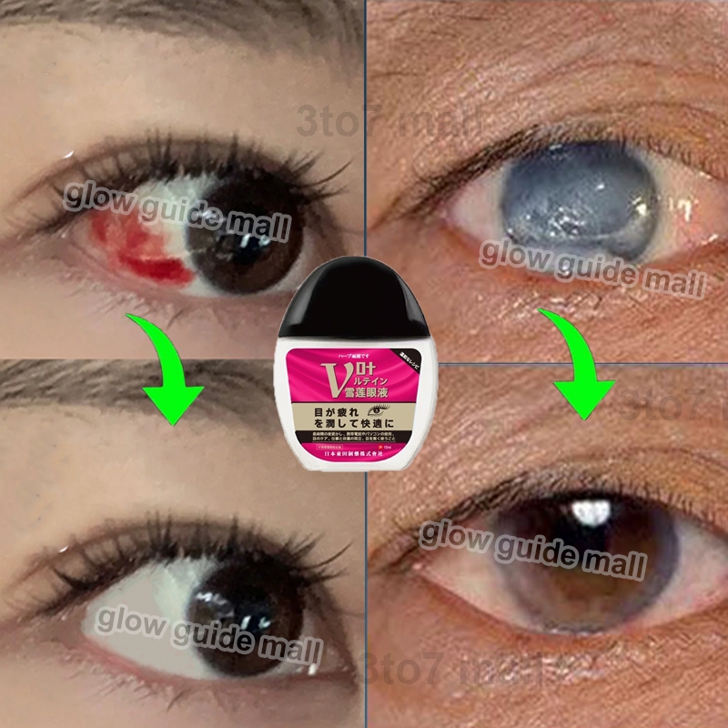 jepang obat tetes mata obat mata katarak obat mata buram eye drop obat mata merah Kering Mata Glukom