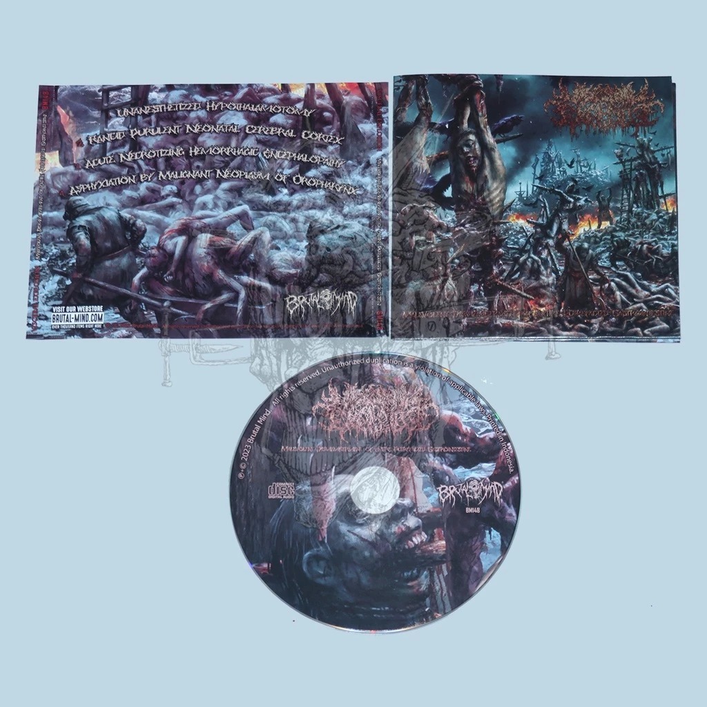 CD - VISCERAL EXPLOSION Malevolent Dismemberment Putrefied Gastrointestine