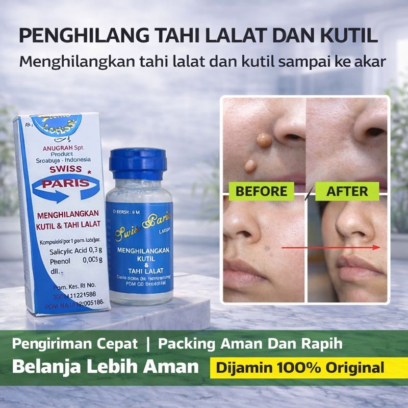 Swiss Paris Lotion Original – Penghilang Tahi Lalat & Kutil Herbal | Aman Tanpa Operasi