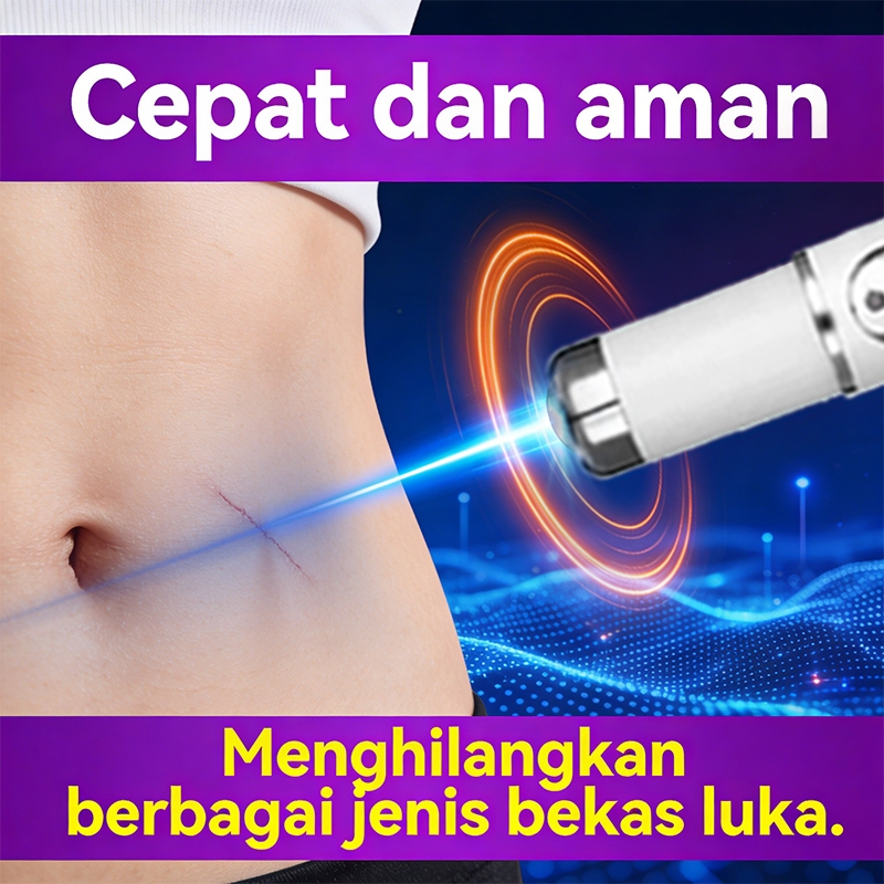 Penghilangan Bekas Luka dengan Laser — mencerahkan kulit, menghilangkan bekas jerawat & noda jerawat