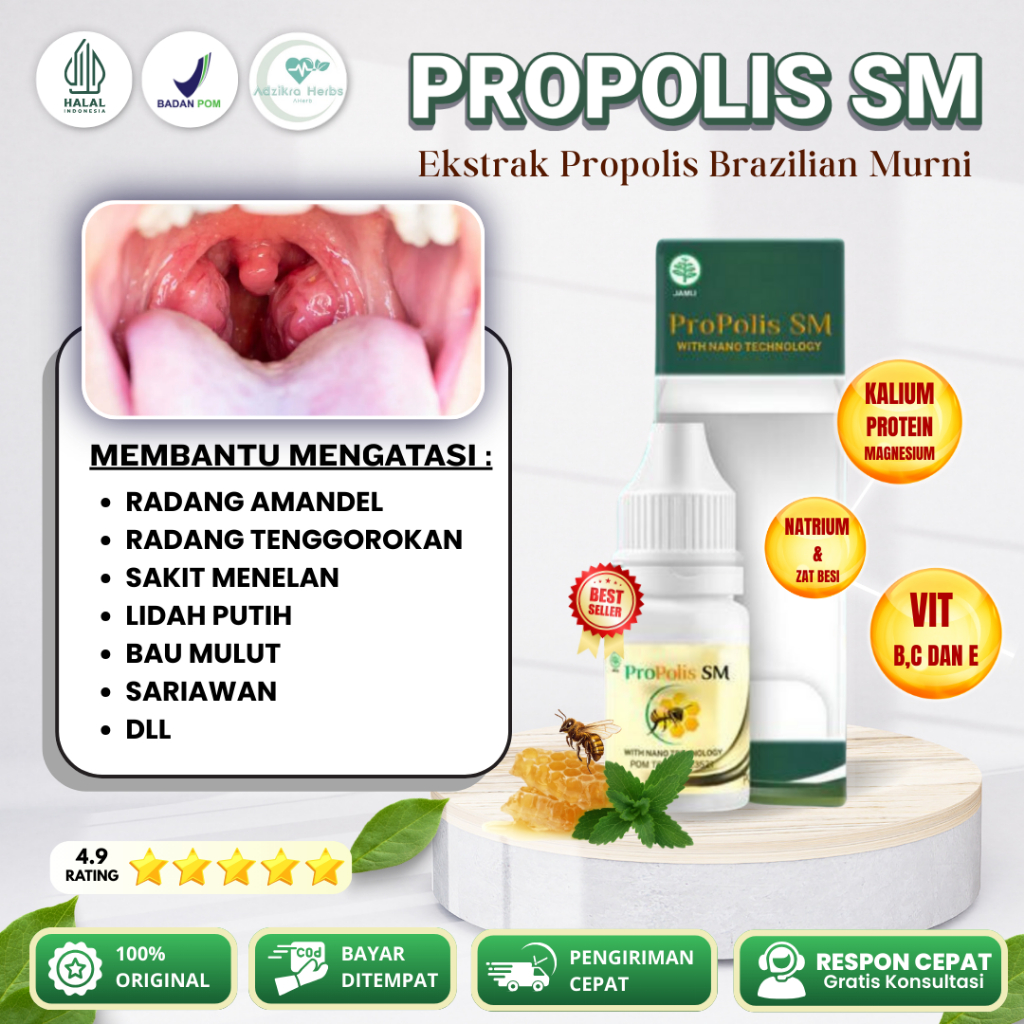 Propolis SM Obat Amandel, Radang Amandel Sakit Tenggorokan Amandel Bengkak Batu Amandel Bau Mulut Sa