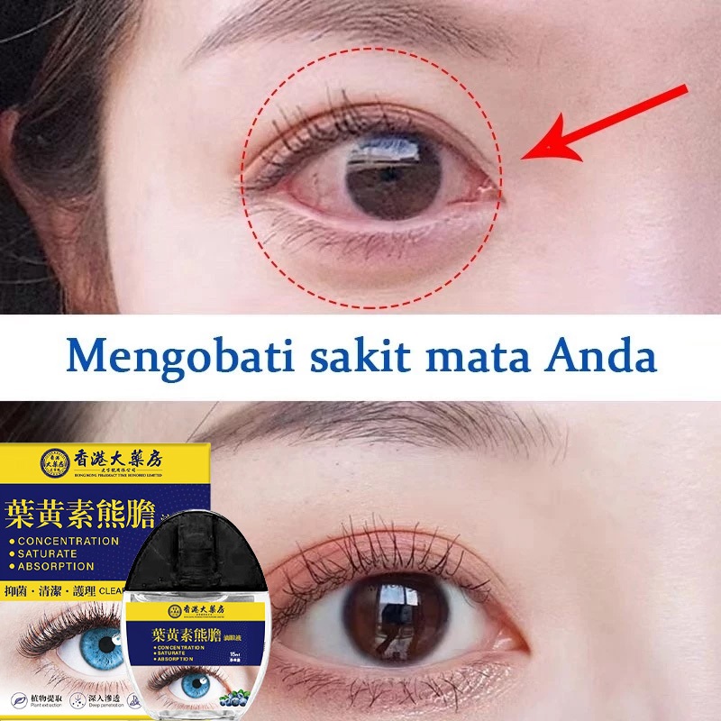 Tetes Mata Lutein Lutein eye drops Khusus untuk mata kuning dan bercak di mata Baik untuk anak-anak 