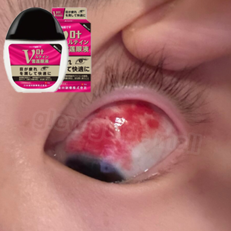 jepang obat tetes mata obat mata katarak obat mata buram eye drop obat mata merah Kering Mata Glukom