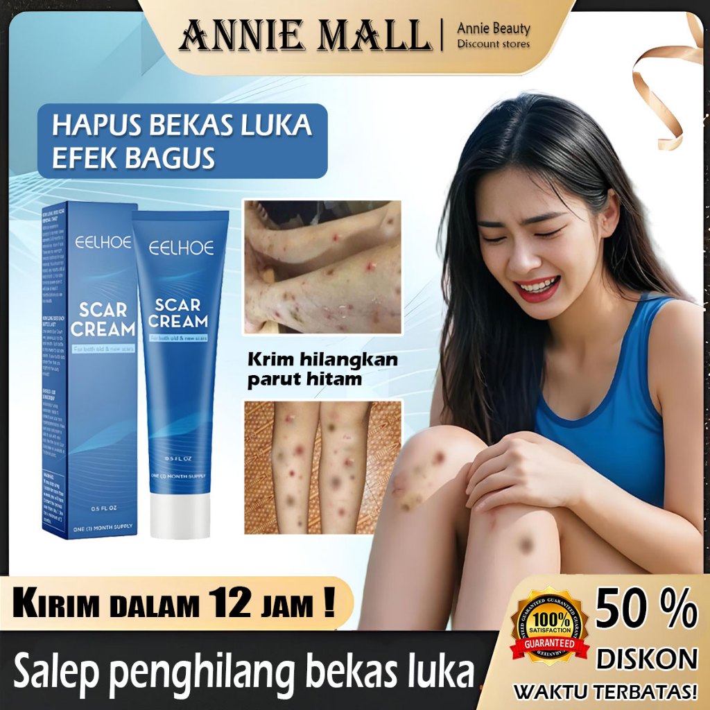 Salep Bekas Luka Penghilang Bekas Koreng Hitam Obat Keloid Paling Ampuh - erawat, keloid Cream / Pen