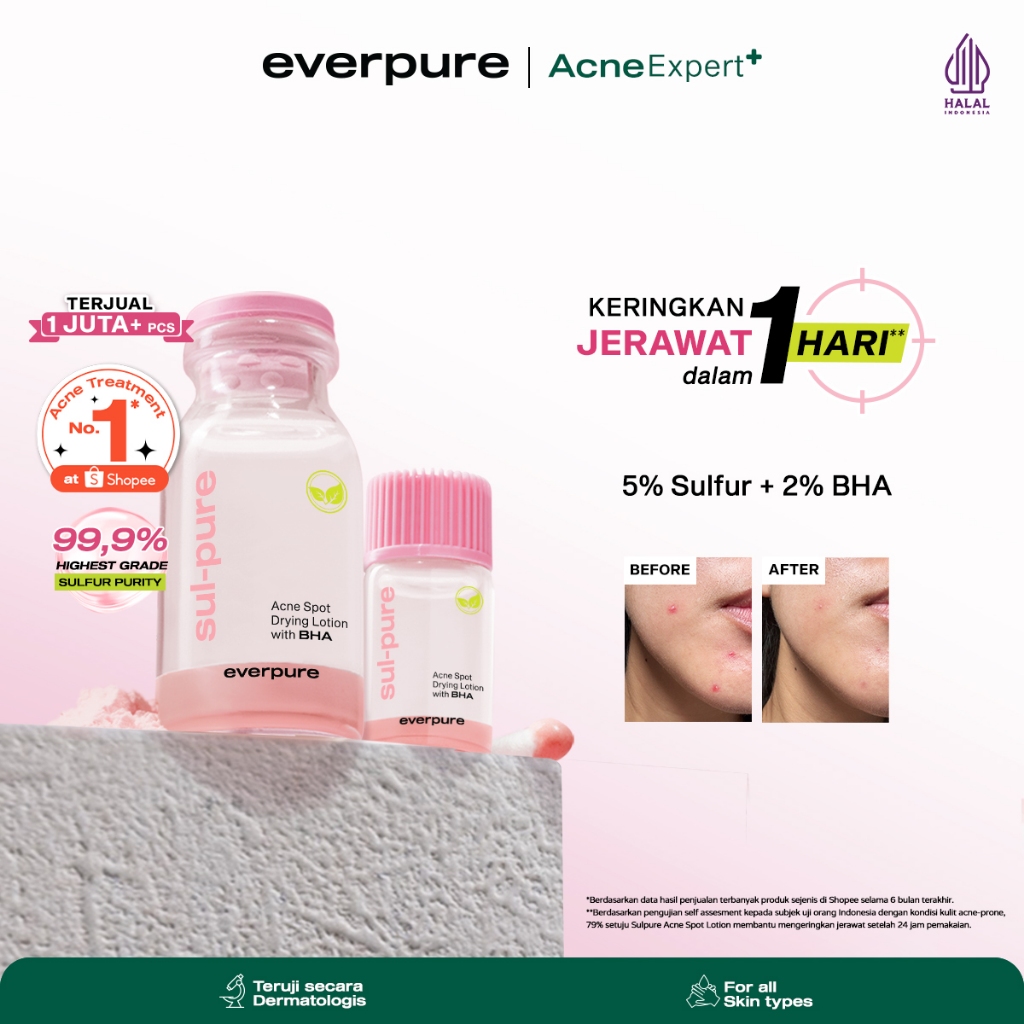 [SPECIAL AFFILIATE] EVERPURE  Sulpure Acne Spot Drying Lotion with BHA - Obat Totol Mengeringkan Jer