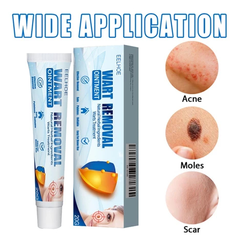 ( BELI 2 GRATIS 1 ) ELHOE Wart Removal Cream 20g - 100%ORI Salep Obat Kutil Paling,Salep Penghilang 