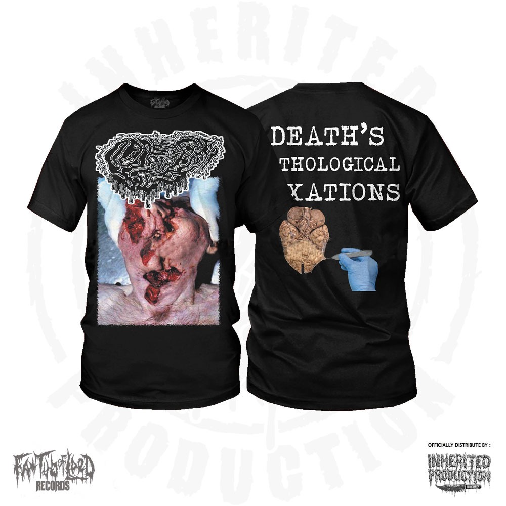 TS – FETAL DEFORMITY – Deaths Pathological Fixations