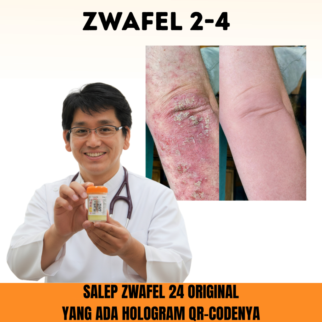 Salep Zwafel 2-4 Original BPOM Obat Aman Scabies Anak & Dewasa Salep 24 Gatal Selangkangan Eksim QR