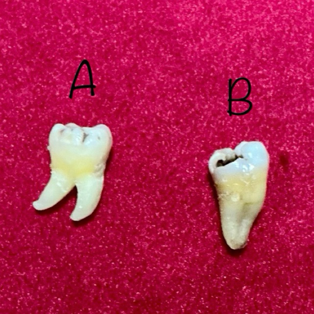 Gigi Molar untuk Praktikum Endo / Gigi Asli Manusia Gigi Praktikum