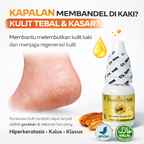 OBAT KAPALAN DI KAKI Hiperkeratosis Kalus Kaki Klavus BPOM Halal - Herbal Kulit Kaki Tebal Mengeras 