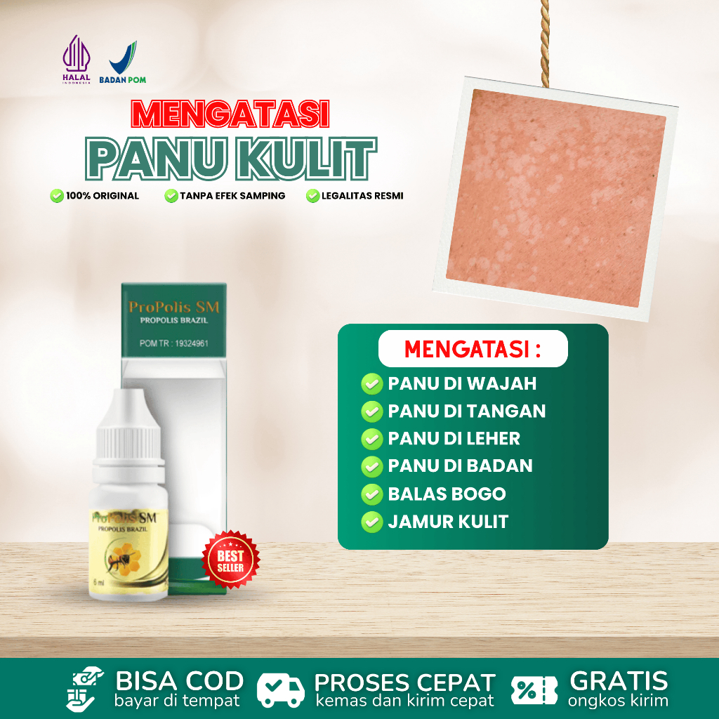 Obat Oles Panu, Panu di Wajah, Panu di Seluruh Badan, Balas Bogo, Jamur Kulit Obat Oles Propolis SM 