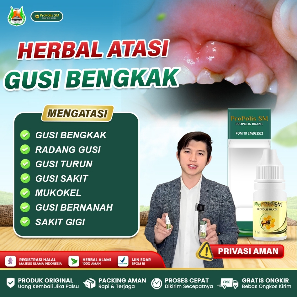 Obat Radang Gusi, Gusi Bengkak, Gusi Turun, Gusi Berdarah, Gusi Sakit, Gusi Bernanah - Propolis SM