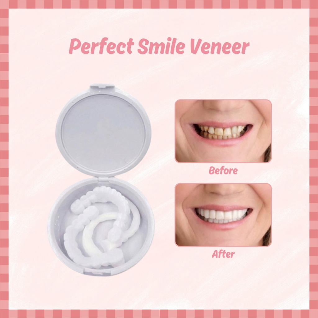 Perfect Smile Veneer 1 Set + Case Veneer Gigi Instan XX150