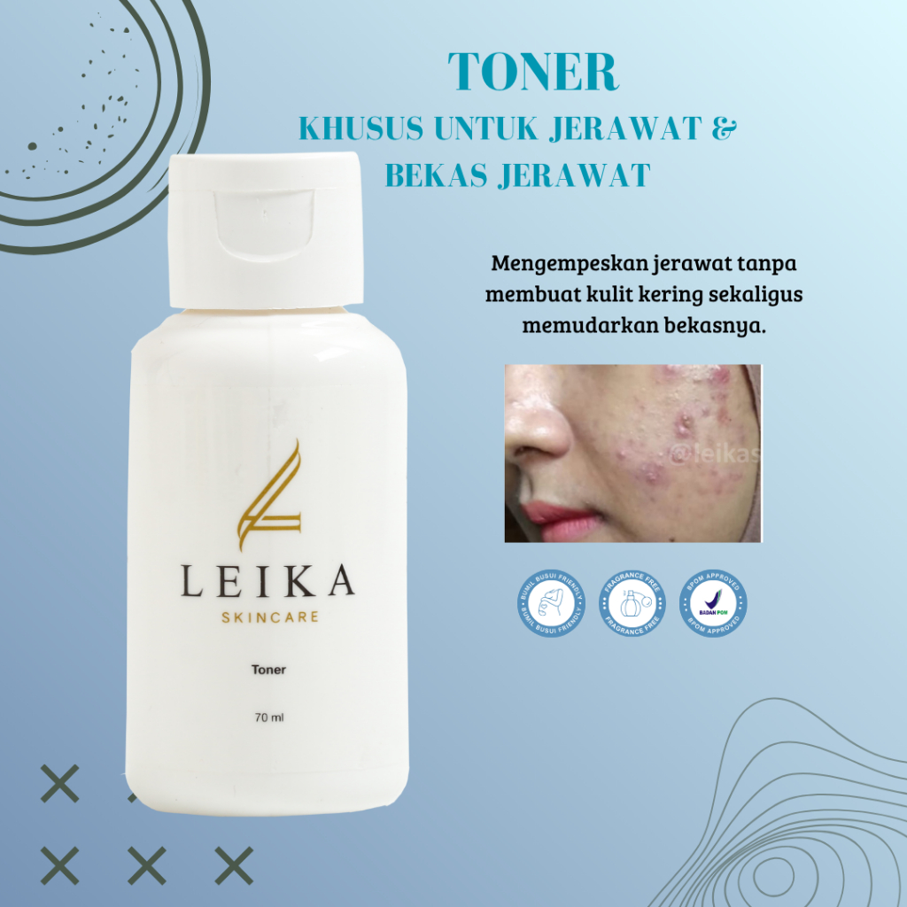 TONER Jerawat Dan Bruntusan Perawatan Wajah Jerawat Bruntusan Toner Wajah Penghilang Jerawat dan Bru