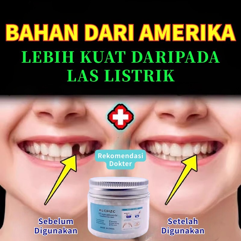 lem gigi palsu tahan lama/tambal gigi/penambal gigi/penambal gigi berlubang/lem gigi palsu/temptooth