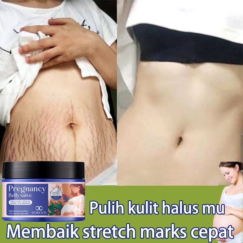 Krim Stretch Mark Herbal Penghilang stretch mark efektif menghilang stretch mark 120g penghilang str