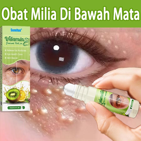 Obat Milia Di Wajah Obat Milia di Mata Obat Milia Di Atas / Bawah Mata, Penghilang Milia di Wajah Kr