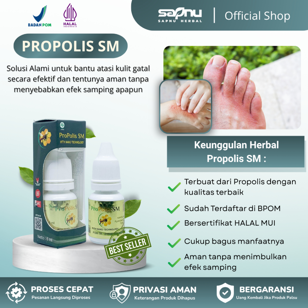 Obat Gatal Berair, Gatal Bintik Berair, Gatal Berair Di Jari Tangan Dan Kaki, Gatal Bintik Berair, B