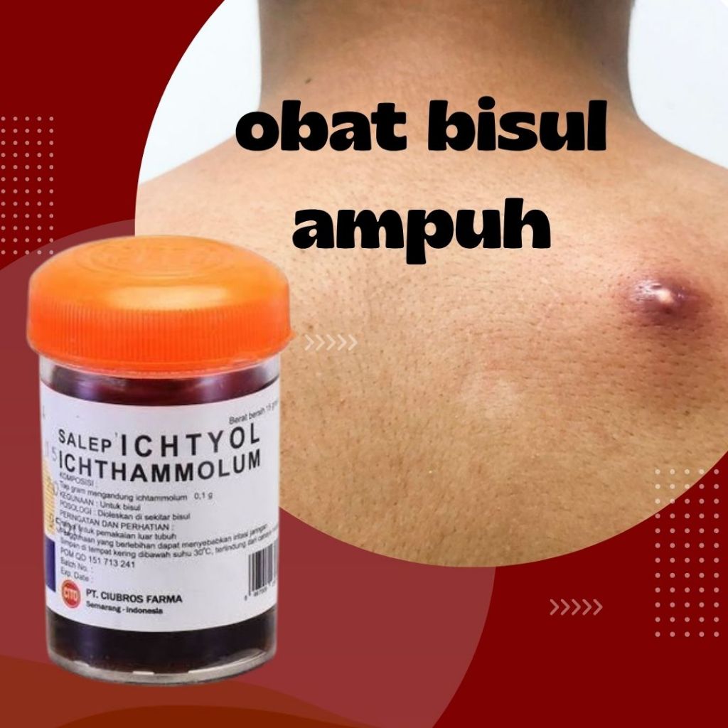 Salep untuk Bisul Ampuh Ichtyol 15 Gram Obat Bisul Di Pantat Bernanah